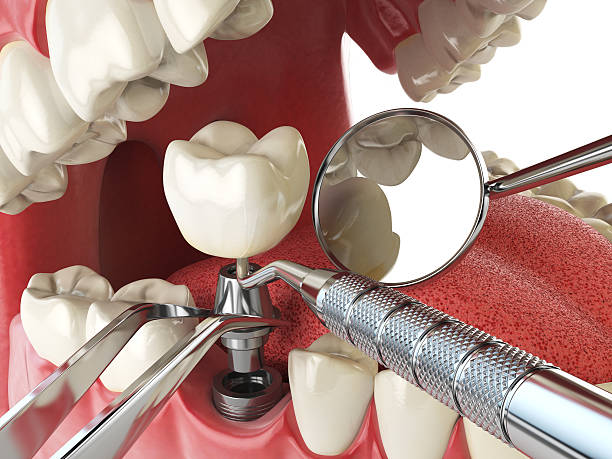 Best Emergency Treatment for Toothache in Benavides, TX