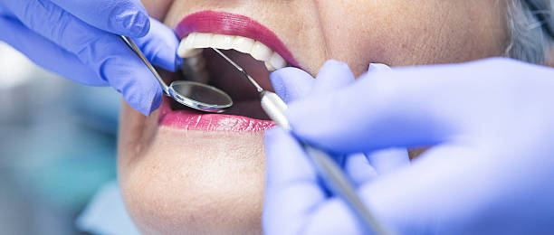 Best Emergency Wisdom Teeth Removal in Benavides, TX